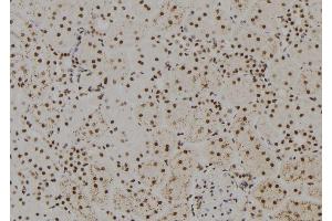 ABIN6279425 at 1/100 staining Rat kidney tissue by IHC-P. (FANCM Antikörper  (Internal Region))