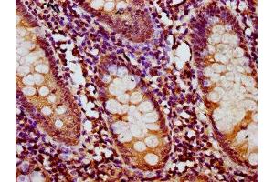 IHC image of ABIN7166723 diluted at 1:400 and staining in paraffin-embedded human appendix tissue performed on a Leica BondTM system.