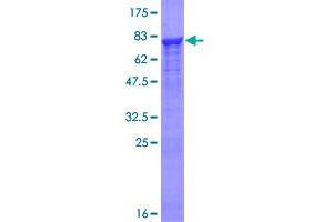 PRP19 Protein (AA 1-504) (GST tag)