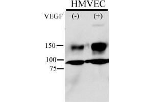 Anti-Phospho-KDR/FLK1- Pab (ABIN389564 and ABIN2839596) is used in Western blot to detect Phospho-KDR/FLK1- in HMVEC cell line lysate. (VEGFR2/CD309 Antikörper  (pTyr996))