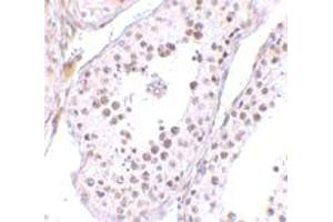 Immunohistochemical staining of human testis tissue with 10 ug/mL MED4 polyclonal antibody . (MED4 Antikörper  (C-Term))