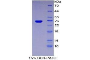 SDS-PAGE analysis of Human Sprouty Homolog 3 Protein.
