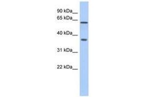 Image no. 1 for anti-ERG, ETS transcription factor (ERG) (AA 360-409) antibody (ABIN6741408) (ERG Antikörper  (AA 360-409))