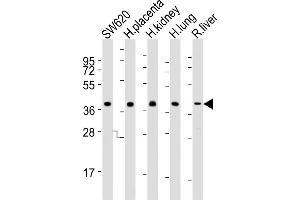 PPAP2B 抗体  (N-Term)