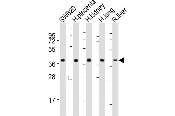 PPAP2B 抗体  (N-Term)