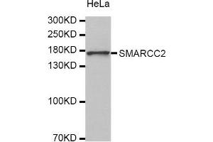 Western Blotting (WB) image for anti-SWI/SNF Related, Matrix Associated, Actin Dependent Regulator of Chromatin, Subfamily C, Member 2 (SMARCC2) (AA 150-250) antibody (ABIN3022693) (SMARCC2 Antikörper  (AA 150-250))