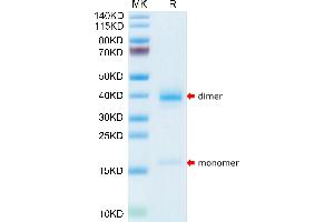 Human Transthyretin/Prealbumin on Tris-Bis PAGE under reduced condition. (TTR Protein (AA 21-147) (His tag))