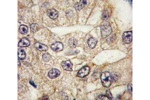 Immunohistochemistry (IHC) image for anti-CD14 (CD14) (AA 54-83) antibody (ABIN3030356)