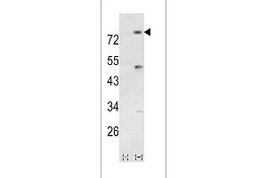 Western blot analysis of PIK3R5 (arrow) using rabbit polyclonal PIK3R5 Antibody (Center) (ABIN392579 and ABIN2842114). (PIK3R5 Antikörper  (AA 392-421))