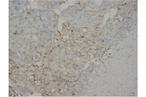 Immunohistochemistry (IHC) image for anti-alpha-Fetoprotein (AFP) antibody (ABIN1105327) (alpha Fetoprotein Antikörper)