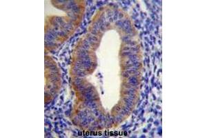 FGD6 Antibody (C-term) immunohistochemistry analysis in formalin fixed and paraffin embedded human uterus tissue followed by peroxidase conjugation of the secondary antibody and DAB staining. (FGD6 Antikörper  (C-Term))