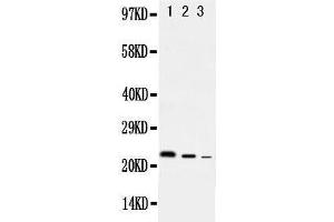 Anti-rat IL10 antibody, Western blotting Lane 1: Recombinant Rat IL10 Protein 10ng Lane 2: Recombinant Rat IL10 Protein 5ng Lane 3: Recombinant Rat IL10 Protein 2