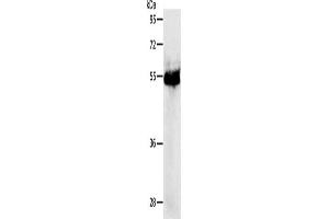 Western Blotting (WB) image for anti-Protein Kinase, CAMP-Dependent, Regulatory, Type I, beta (PRKAR1B) antibody (ABIN2426823) (PRKAR1B Antikörper)