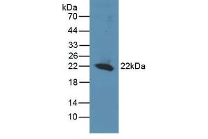 Figure. (REV1 Antikörper  (AA 301-478))
