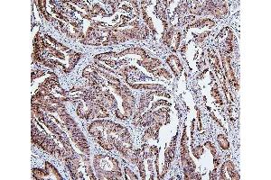IHC analysis of HSPH1 using anti-HSPH1 antibody (ABIN7602237). (HSPH1 Antikörper  (AA 653-858))