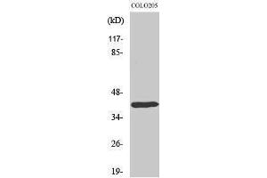 Western Blotting (WB) image for anti-Distal-Less Homeobox 4 (DLX4) (Internal Region) antibody (ABIN3184316) (DLX4 Antikörper  (Internal Region))