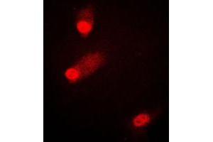 Immunofluorescent analysis of MKK4 (pS80) staining in HEK293T cells.