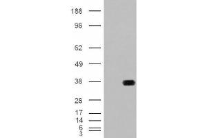 Image no. 2 for anti-Hydroxyacyl-CoA Dehydrogenase (HADH) (Internal Region) antibody (ABIN374901) (HADH Antikörper  (Internal Region))