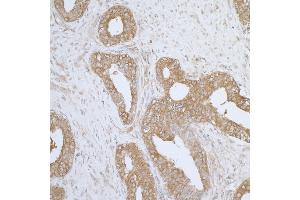 Immunohistochemistry (IHC) image for anti-Aminoacyl tRNA Synthetase Complex-Interacting Multifunctional Protein 1 (AIMP1) (AA 262-312) antibody (ABIN7455058) (AIMP1 Antikörper  (AA 262-312))