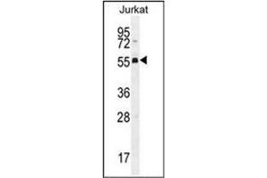 Western blot analysis of PODNL1 Antibody (Center) Cat. (PODNL1 Antikörper  (Middle Region))