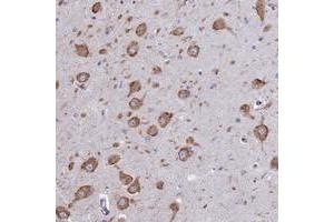 Immunohistochemical staining of human hippocampus with WDR35 polyclonal antibody  shows strong cytoplasmic positivity in neurons.