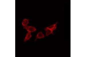 ABIN6275080 staining Hela by IF/ICC. (DNAJC5 Antikörper  (Internal Region))