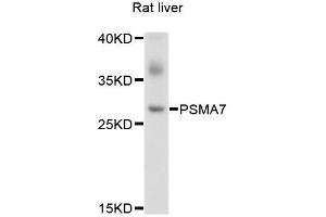Western blot analysis of extracts of rat liver, using PSMA7 antibody. (PSMA7 Antikörper  (AA 1-248))