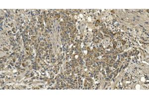IHC analysis of RGS6 using anti-RGS6 antibody (ABIN7602326). (RGS6 Antikörper  (AA 7-357))