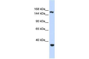 WB Suggested Anti-EIF4G3 Antibody Titration:  0. (EIF4G3 Antikörper  (Middle Region))