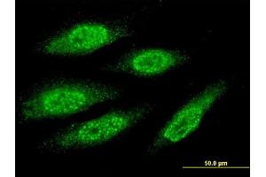 Immunofluorescence of monoclonal antibody to MAGEA8 on HeLa cell. (MAGEA8 Antikörper  (AA 1-318))