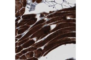 Immunohistochemical staining (Formalin-fixed paraffin-embedded sections) of human skeletal muscle with MYH6 monoclonal antibody, clone CL2148  shows strong cytoplasmic immunoreactivity in striated muscle fibers. (MYH6 Antikörper)