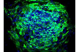 Immunofluorescent staining of human ES cell line (TRA1-81 Antikörper)