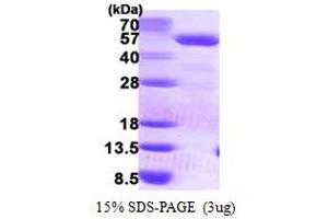SDS-PAGE (SDS) image for Phosphate Cytidylyltransferase 2, Ethanolamine (PCYT2) (AA 1-389) protein (His tag) (ABIN6386869)