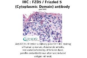 Image no. 1 for anti-Frizzled Family Receptor 5 (FZD5) (3rd Cytoplasmic Domain) antibody (ABIN1734503) (FZD5 Antikörper  (3rd Cytoplasmic Domain))