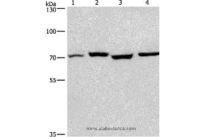 Western blot analysis of Human fetal liver and mouse stomach tissue, hela and hepG2 cell, using ARNTL Polyclonal Antibody at dilution of 1:450 (ARNTL Antikörper)