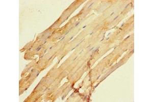 Immunohistochemistry of paraffin-embedded human skeletal muscle tissue using ABIN7168727 at dilution of 1:100 (SCAMP3 Antikörper  (AA 2-170))