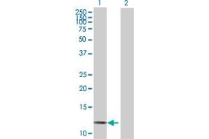 Western Blot analysis of LAMA4 expression in transfected 293T cell line by LAMA4 MaxPab polyclonal antibody. (LAMa4 Antikörper  (AA 1-120))