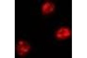 Immunofluorescent analysis of FIR staining in Hela cells. (FARP2 Antikörper)