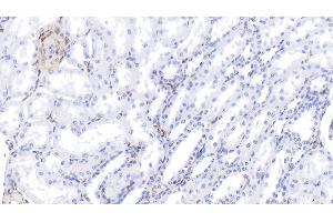 Detection of GAL1 in Bovine Kidney Tissue using Polyclonal Antibody to Galectin 1 (GAL1) (LGALS1/Galectin 1 Antikörper  (AA 1-135))