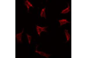 Immunofluorescence (fixed cells) (IF/ICC) image for anti-Ribosomal Protein S6 (RPS6) (C-Term) antibody (ABIN6264912)