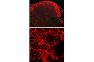 Upper: Immuofluorescent detection of Tac1 polyclonal antibody  in rat spinal cord dorsal horn (red fluorescence). (TAC1 Antikörper)