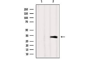 Western blot analysis of extracts from Mouse brain, using CAPZA1 Antibody. (CAPZA1 Antikörper  (Internal Region))