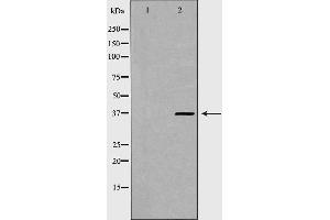 Western blot analysis of Hela whole cell lysates, using PSMD7 Antibody. (PSMD7 Antikörper  (C-Term))