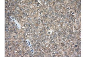 Immunohistochemical staining of paraffin-embedded Human colon tissue using anti-PDE4A mouse monoclonal antibody. (PDE4A Antikörper)