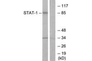Western blot analysis of extracts from COLO205 cells, using STAT1 (Ab-701) Antibody. (STAT1 Antikörper  (AA 668-717))