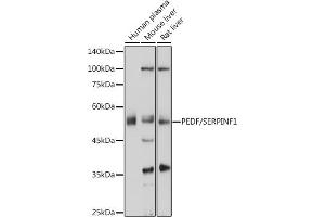 Western blot analysis of extracts of various cell lines, using PEDF/PEDF/SERPINF1 antibody (ABIN6131334, ABIN6147606, ABIN6147607 and ABIN6215471) at 1:1000 dilution. (PEDF Antikörper  (AA 1-200))