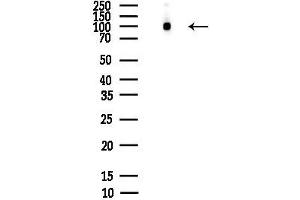 anti-Cullin 4B (CUL4B) (N-Term) antibody