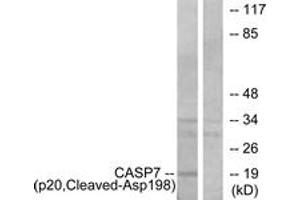 Western blot analysis of extracts from Jurkat cells, treated with etoposide 25uM 24h, using Caspase 7 (p20,Cleaved-Asp198) Antibody. (Caspase 7 Antikörper  (Cleaved-Asp198))