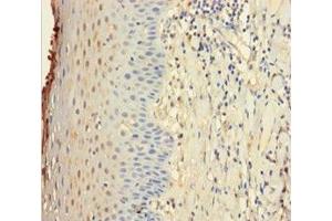 Immunohistochemistry of paraffin-embedded human tonsil tissue using ABIN7156855 at dilution of 1:100 (IL22 Receptor alpha 1 Antikörper  (AA 250-573))