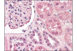 Image no. 1 for anti-Transcription Factor AP-2 alpha (Activating Enhancer Binding Protein 2 Alpha) (TFAP2A) (AA 3-14) antibody (ABIN303152)